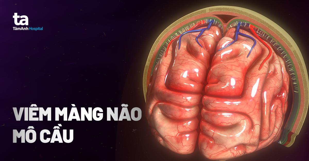 Bệnh viêm màng não do não mô cầu